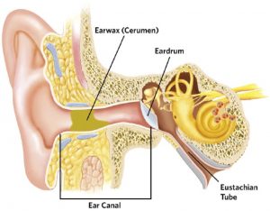 la cire des oreilles peuvent boucher et empêcher d'entendre